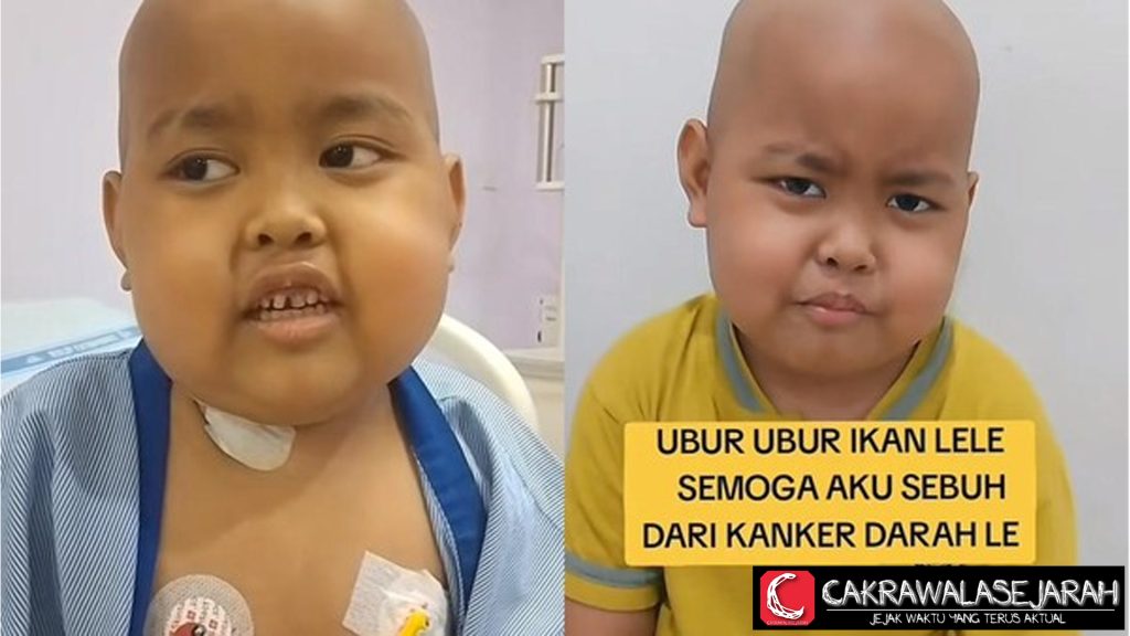 Devin, 6 Tahun, Idap Kanker Darah Bogor: Waspadai Gejala Awal!